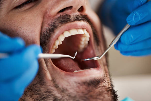 Best Emergency Root Canal Treatment in Dunnellon, FL